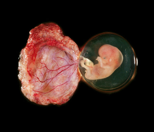 Potential placenta problems
